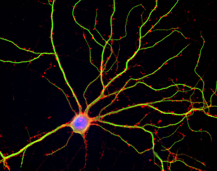 dendritic spines