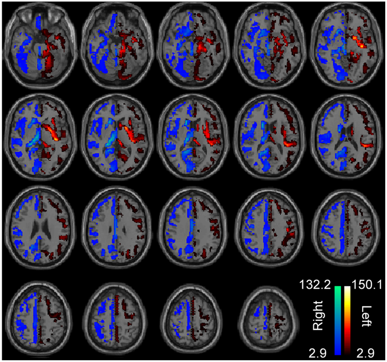 left brain right brain